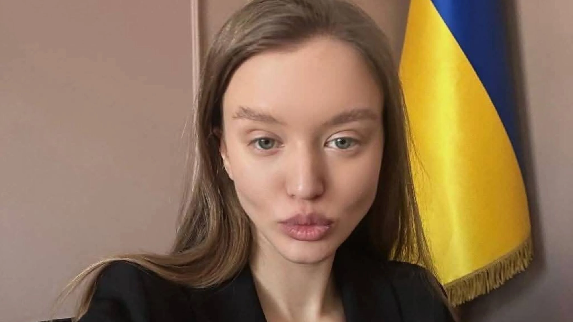 «Не ейджизм, а сексизм»: соцмережі вибухнули через призначення 25-річної Анни Дорош у МОЗ