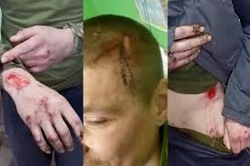 Скандал у полку «Скеля» і заклики до відставки: у Раді зробили гучну заяву щодо долі Сирського